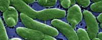 Vibrio vulnificus from internet 1